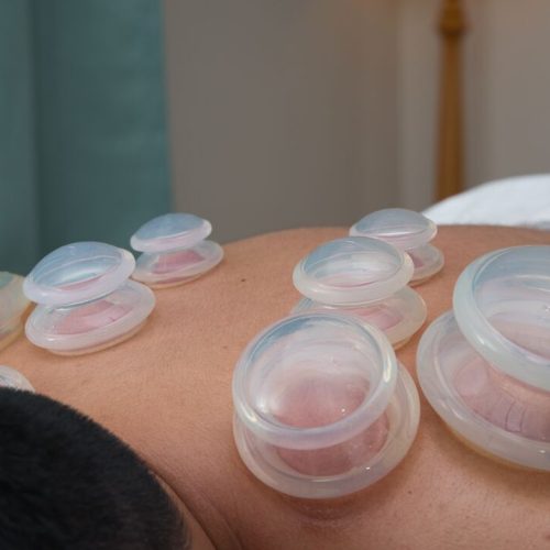 Publications 5 The Ancient Art of Cupping Massage